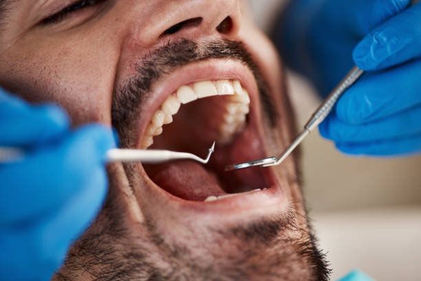 Dental X-Rays and Imaging in Edgecliff Village, TX